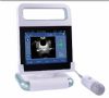 fda & ce certificate palm bladder scanner ultrasound scanner ult