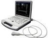 laptop ultrasound machine color doppler scanner ultrasound syste